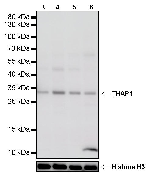 THAP1 Recombinant Rabbit mAb (S-4023-36)