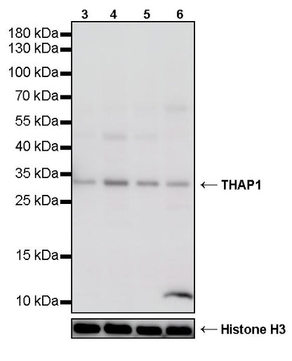 THAP1 Recombinant Rabbit mAb (S-4023-36)