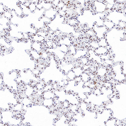 Phospho-STAT1 (Ser727) Recombinant Rabbit mAb