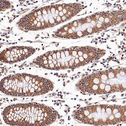 SMAD3 Recombinant Rabbit mAb (S-3147-36)