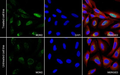 MDM2 Recombinant Rabbit mAb (S-1236-49)