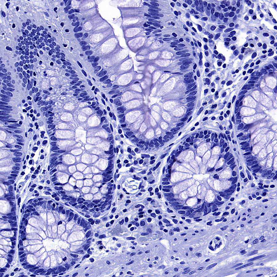 ITPR1 Recombinant Rabbit mAb (S-4530-5)