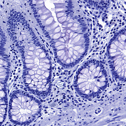 ITPR1 Recombinant Rabbit mAb (S-4530-5)