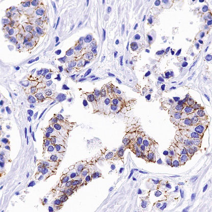 Claudin 3+Claudin 9 Recombinant Rabbit mAb (SDT-1452-69)