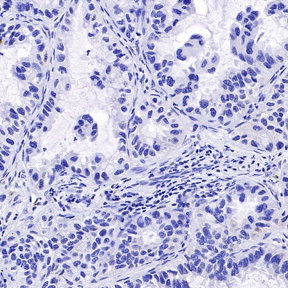 MelanA Recombinant Rabbit mAb (SDT-3352)