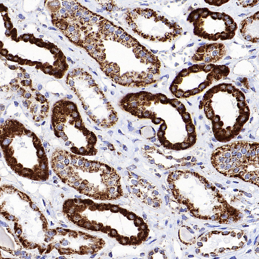 MTCO2 Recombinant Rabbit mAb (S-1891-72)