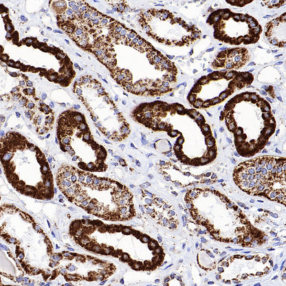 MTCO2 Recombinant Rabbit mAb (S-1891-72)