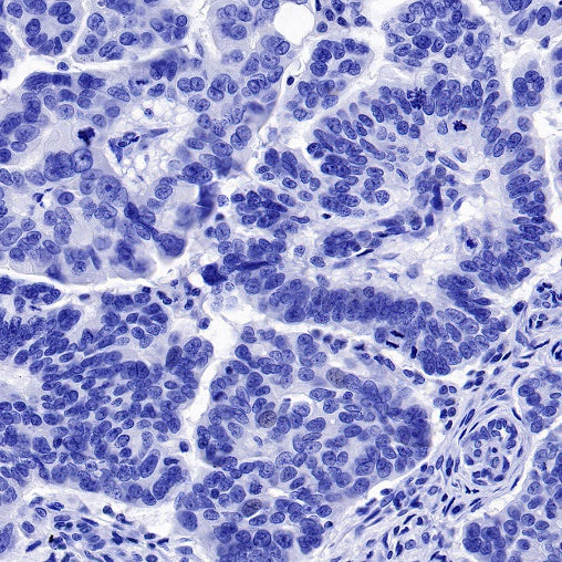 Cardiac Troponin I Recombinant Rabbit mAb (S-1352-28)
