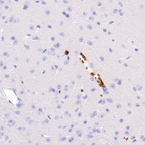 Mouse TER-119/Erythroid Cells Recombinant Rat mAb (TER-119)