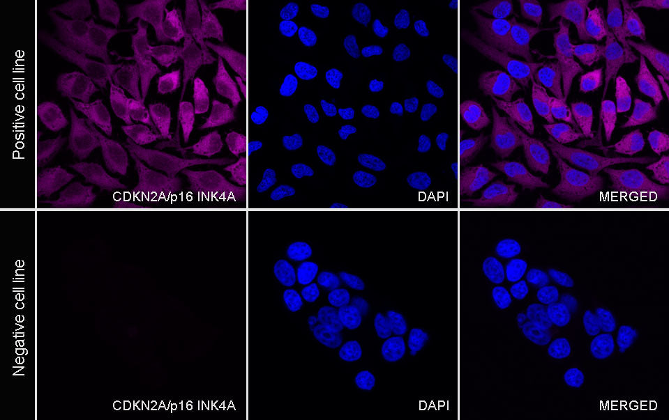 CDKN2A/p16 INK4A Recombinant Mouse mAb (Cy5 Conjugate) (SDT-4675)