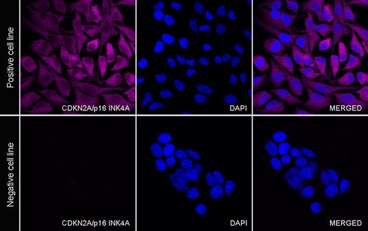 CDKN2A/p16 INK4A Recombinant Mouse mAb (Cy5 Conjugate) (SDT-4675)