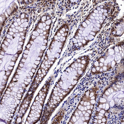 Stat3 Recombinant Rabbit mAb (S-1393-64)