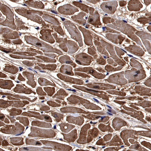 Cardiac Troponin I Recombinant Rabbit mAb (S-1352-28)