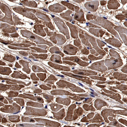 Cardiac Troponin I Recombinant Rabbit mAb (S-1352-28)