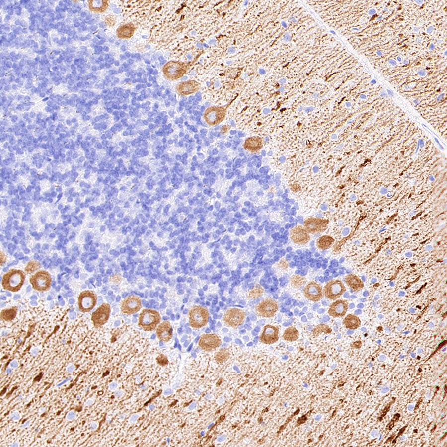 ITPR1 Recombinant Rabbit mAb (S-4530-5)