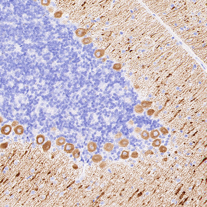 ITPR1 Recombinant Rabbit mAb (S-4530-5)