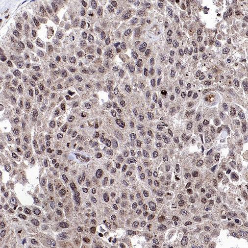EGR1 Rabbit Polyclonal Antibody