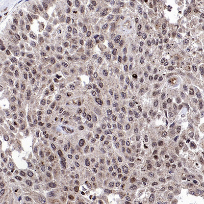 EGR1 Rabbit Polyclonal Antibody
