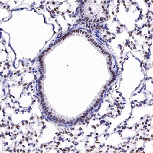 Histone H4 (acetyl K5) Recombinant Rabbit mAb (S-1464-112)