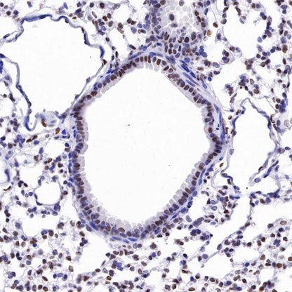 Histone H4 (acetyl K5) Recombinant Rabbit mAb (S-1464-112)