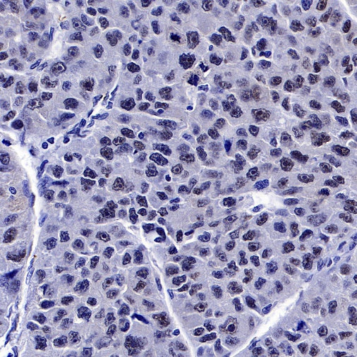 PES1 Recombinant Rat mAb (SDT-R197)