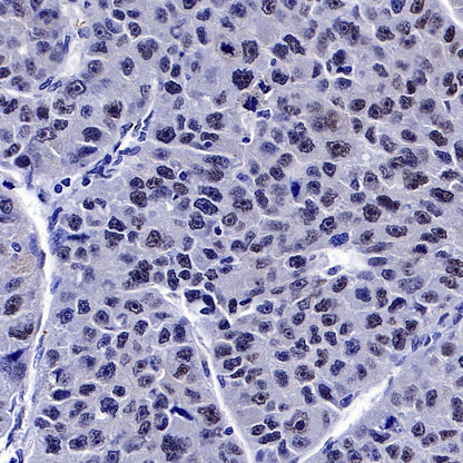 PES1 Recombinant Rat mAb (SDT-R197)