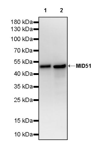 MID51 Recombinant Rabbit mAb (S-3570-28)