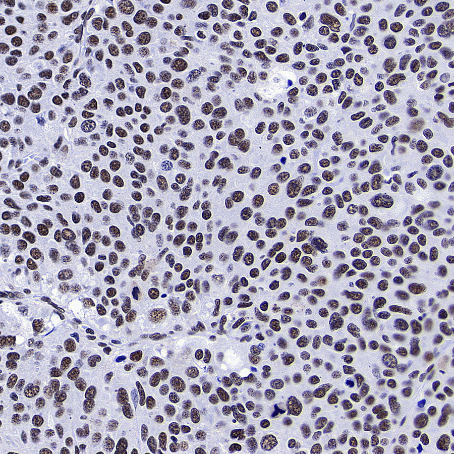 RBM10 Recombinant Rabbit mAb (S-4370-47)