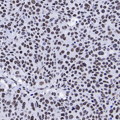 RBM10 Recombinant Rabbit mAb (S-4370-47)