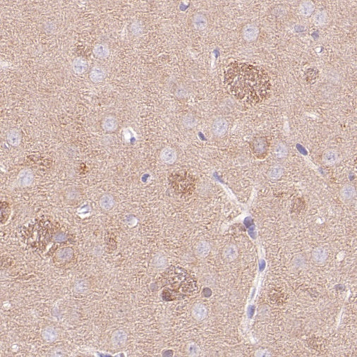 LC3B Recombinant Rabbit mAb (S-1599-142)