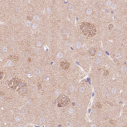 LC3B Recombinant Rabbit mAb (S-1599-142)