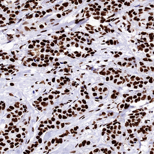 HDAC2 Recombinant Rabbit mAb (S-1474-27)