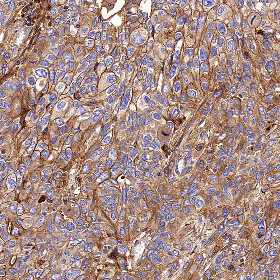 PTK7 Recombinant Rabbit mAb (SDT-2432-156)
