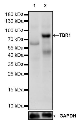 TBR1 Recombinant Rabbit mAb (S-1102-34)