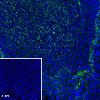 Podoplanin (D2-40) Recombinant Rabbit mAb,PBS Only (SDT-1178-8)