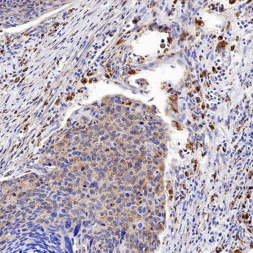 Cathepsin B Recombinant Rabbit mAb (S-1067-7)