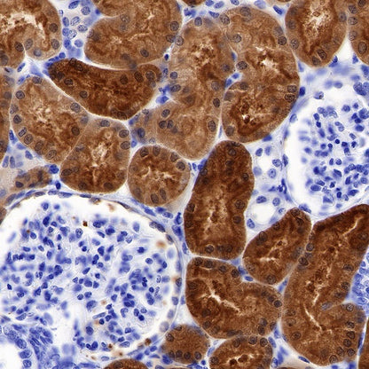 BHMT Recombinant Rabbit mAb (S-R286)