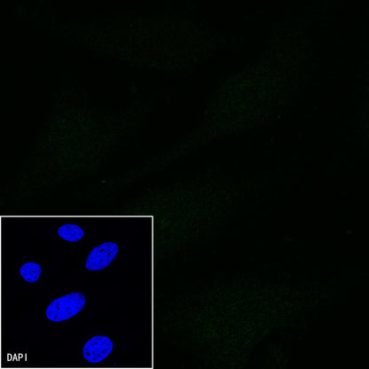 CD5 Mouse mAb (S-576-35)