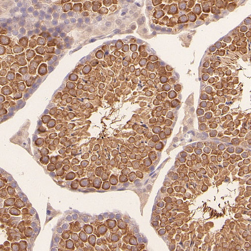 IFT88 Recombinant Rabbit mAb (S-2187-107)