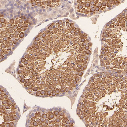 IFT88 Recombinant Rabbit mAb (S-2187-107)