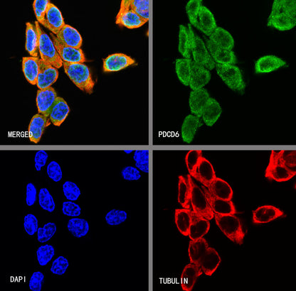PDCD6 Recombinant Rabbit mAb (S-578-98)