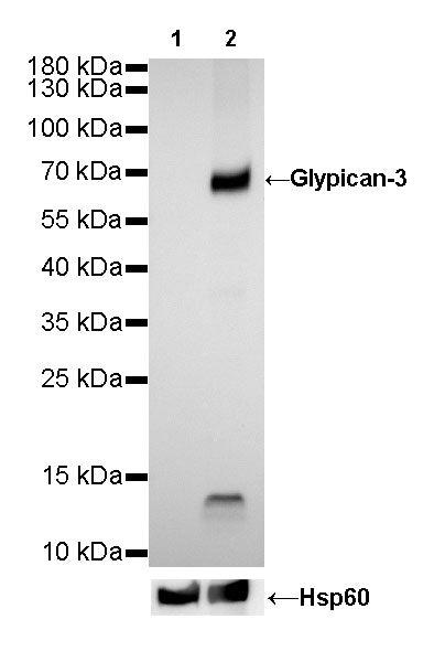 Glypican-3 Recombinant Rabbit mAb,PBS Only (SDT-R032)