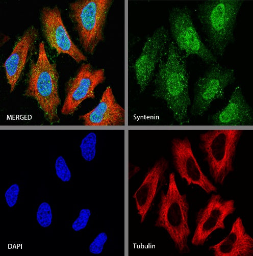 Syntenin Recombinant Rabbit mAb (S-1692-5)