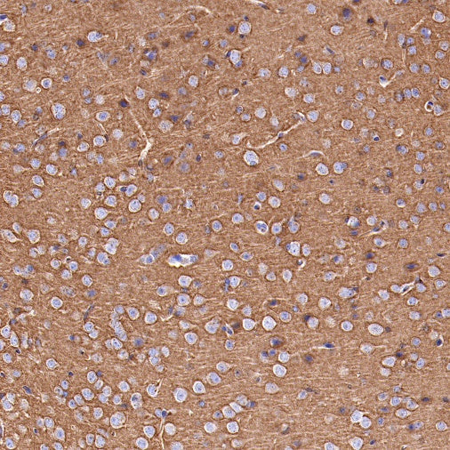 SNAP25 Recombinant Rabbit mAb (S-1828-67)