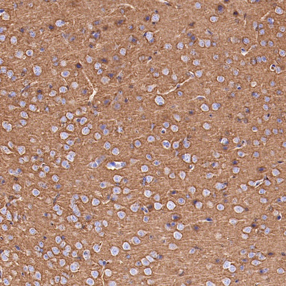 SNAP25 Recombinant Rabbit mAb (S-1828-67)