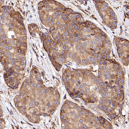 NMT1 Recombinant Rabbit mAb (S-2986-17)