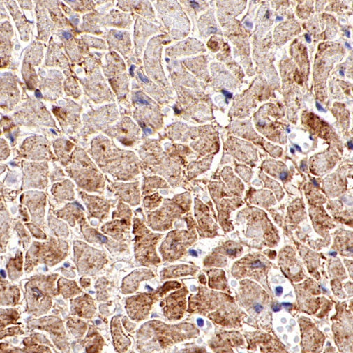 GLUT4 Recombinant Rabbit mAb (S-584-50)