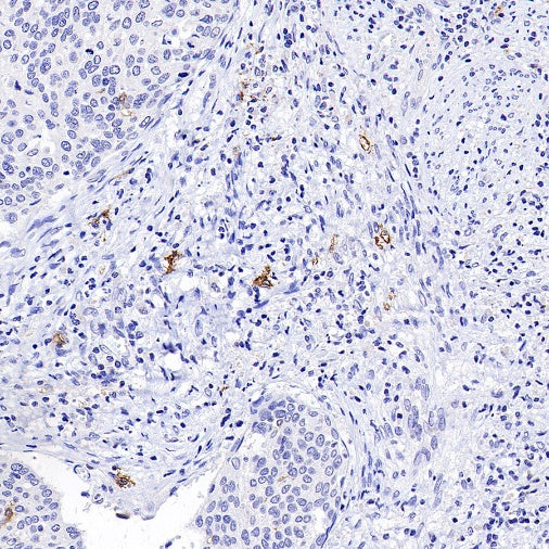 FCER1A/FcεRIα Recombinant Rabbit mAb (S-1697-174)