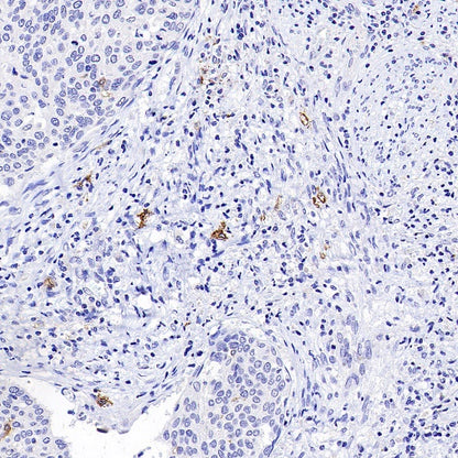 FCER1A/FcεRIα Recombinant Rabbit mAb (S-1697-174)