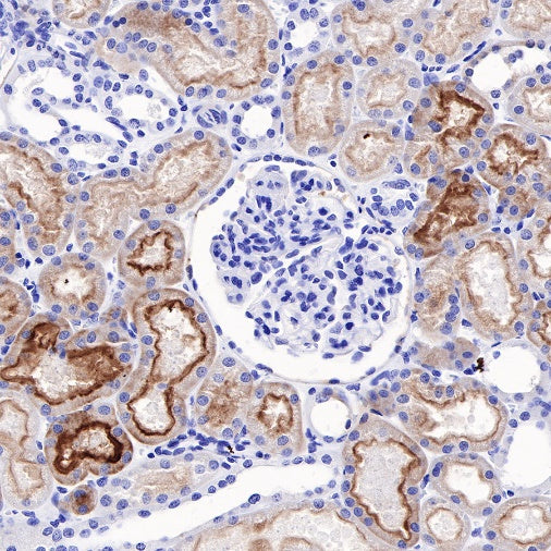Human folate receptor alpha Recombinant Rabbit mAb (SDT-719-20-2)
